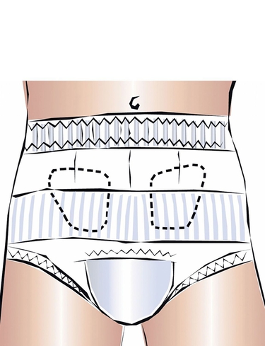 &nbsp;HERNIA TRUNKS&nbsp;-&nbsp;click to view larger image